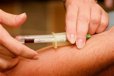 Spinalna igla + proizvođač: trendovi u industriji i budući izazovi